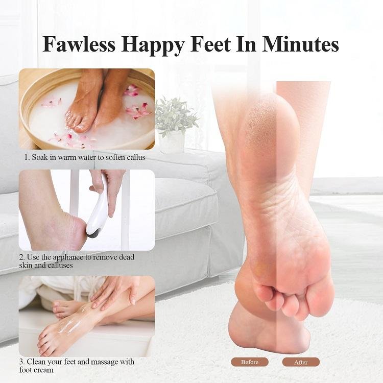 TOUCHBeauty Electric Callus Remover Waterproof Feet Care Tool Electric Pedicure Device Remove Dead Skin - Image 6